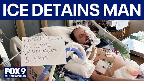 Man with skin condition detained by ICE