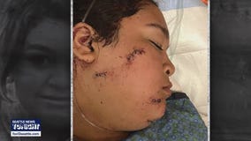 Teens arrested in violent Seattle stabbing