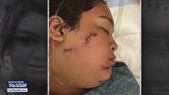 Teens arrested in violent Seattle stabbing