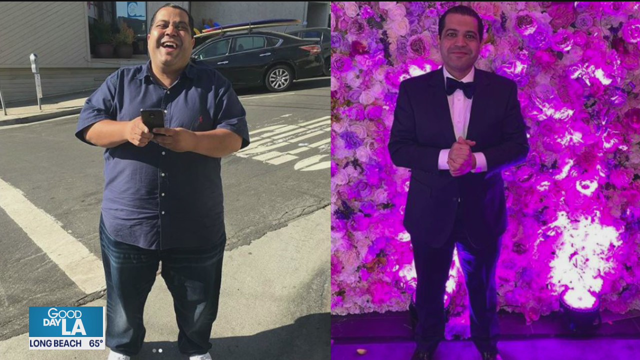 LA Times columnist Arash Markazi loses 130 pounds