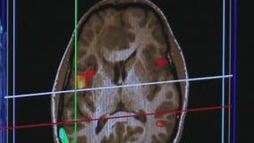 Sitting in traffic for just 2 hours can lead to brain damage, study shows