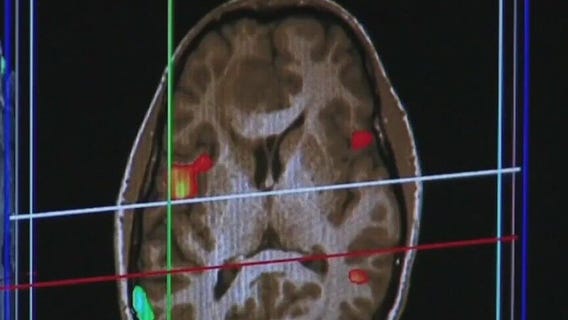 Sitting in traffic for just 2 hours can lead to brain damage, study shows