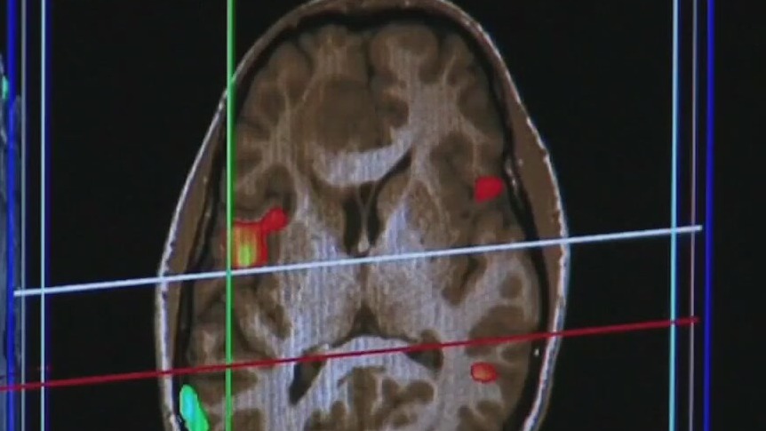 Sitting in traffic for just 2 hours can lead to brain damage, study shows