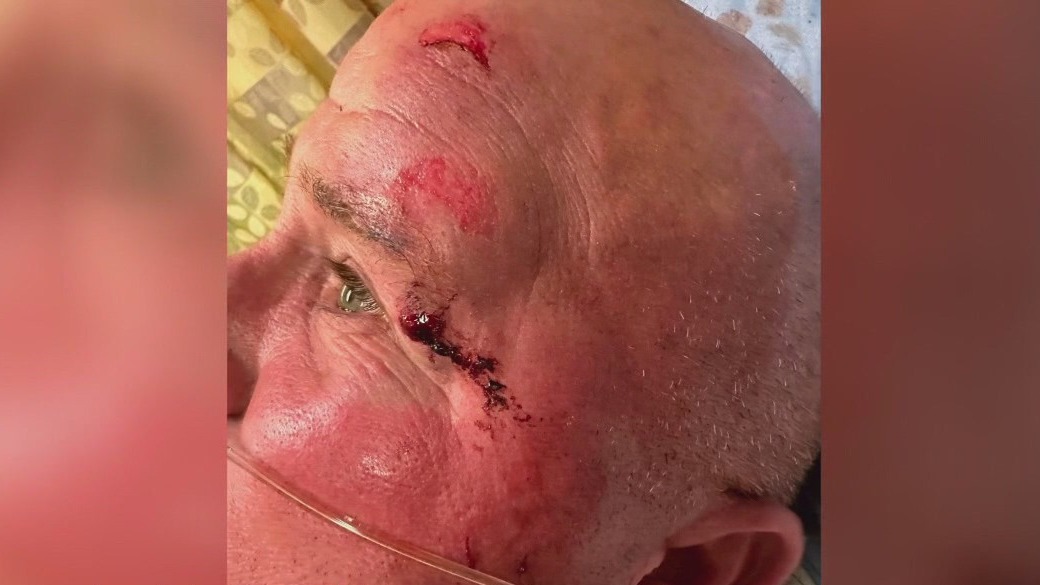 Man says he was attacked over Trump flag