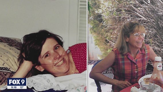 Shoreview woman who defied odds after lung transplant hoping for another miracle