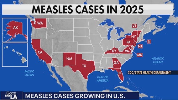 Measles cases growing in U.S.