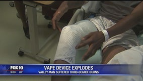 Man injured when his vape pen explodes