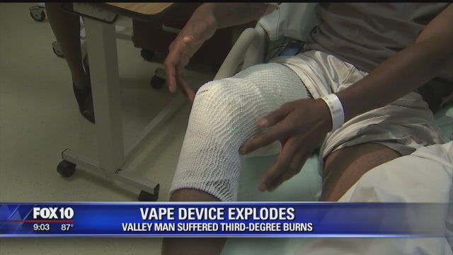 Man injured when his vape pen explodes