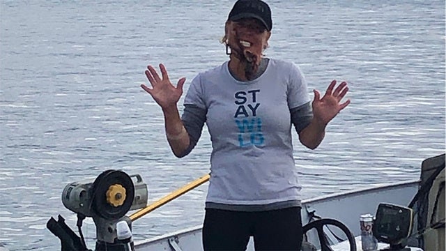 Posing with octopus on face sends Washington woman to hospital