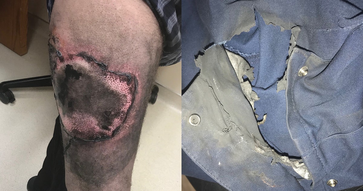 arizona product liability tobacco injury Phoenix Lawyer Phoenix Product Liability Lawyers