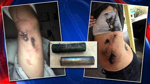 Woman claims second-degree burns from exploding vape batteries