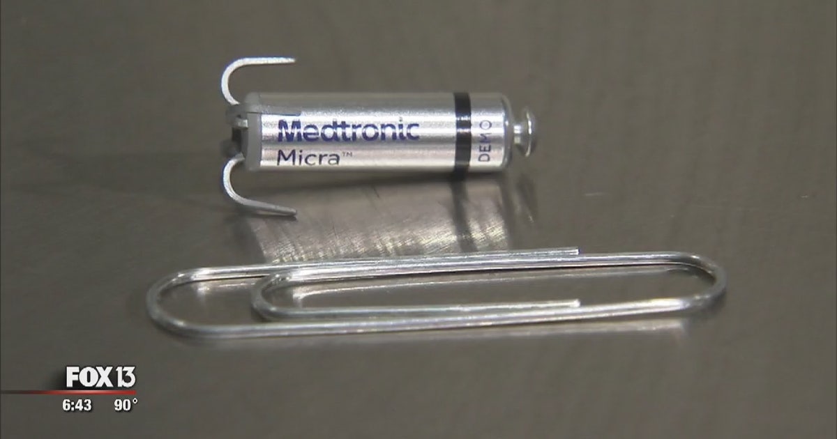 Phoenix Pacemaker Tiny pacemaker could revolutionize cardiac care | FOX 10 Phoenix