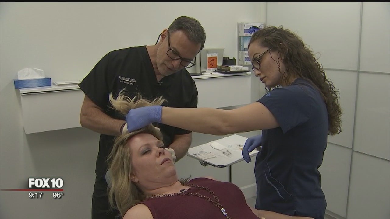 Phoenix doctor offers unique hair loss treatment