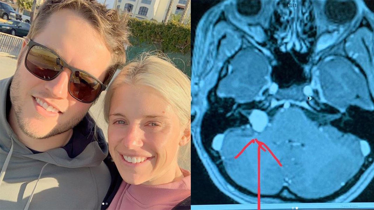 Kelly Stafford, wife of Lions QB Matt Stafford, to have brain tumor surgery