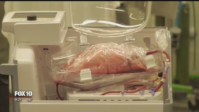 Lungs in a box: Organ Care System is a game-changer for transplant surgery