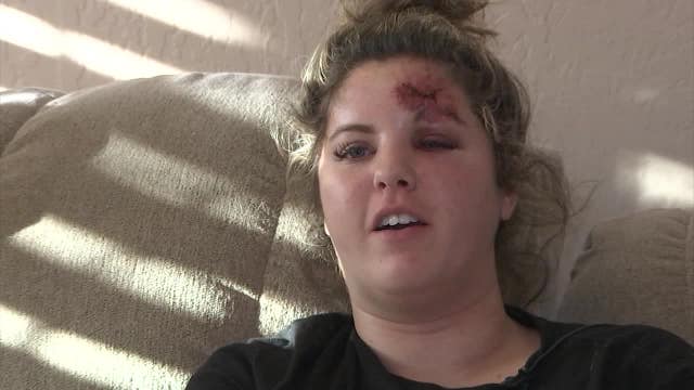 Scooter rider injured following Halloween hit-and-run crash in Scottsdale now back home