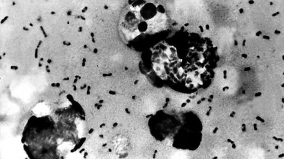 Bubonic plague bacteria from a patient in a photo obtained in January 2003 from the Centers for Disease Control and Prevention (CDC). (CDC/AFP/File)