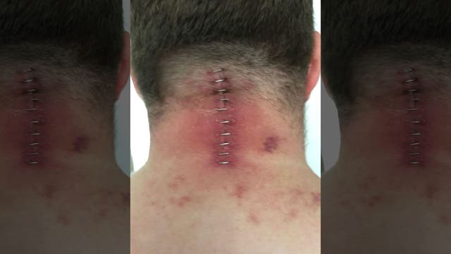 Supermarket fridge door unhinges, lands on man's neck 'like a guillotine' in freak accident