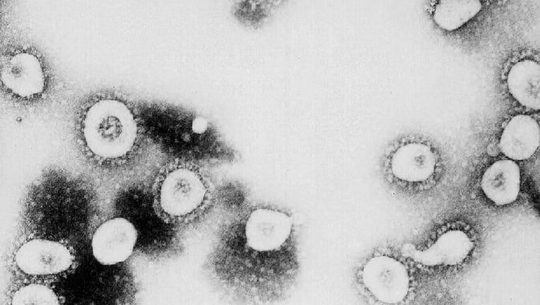 FILE: This undated handout photo from the Centers for Disease Control and Prevention (CDC) shows a microscopic view of the Coronavirus at the CDC in Atlanta, Georgia. According to the CDC the virus that causes Severe Acute Respiratory Syndrome (SARS) might be a