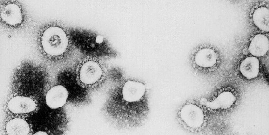 Cdc Investigating Dozens Of Potential Patients Across 22 States As