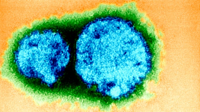 Hantavirus kills man in coronavirus-hit China, 32 others tested, report says