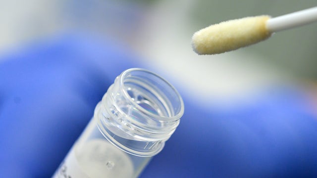 Valleywise Health's new testing quickly detects COVID-19