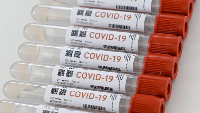 35 percent of coronavirus patients could be asymptomatic, CDC says