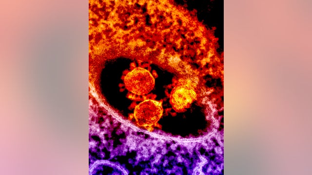 Nearly 1,500 new Arizona COVID-19 cases reported; attributed to 'pre-pandemic' behavior