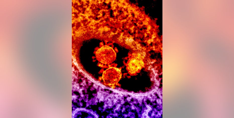 Upcoming flu season a concern for medical experts amid ongoing COVID-19 pandemic