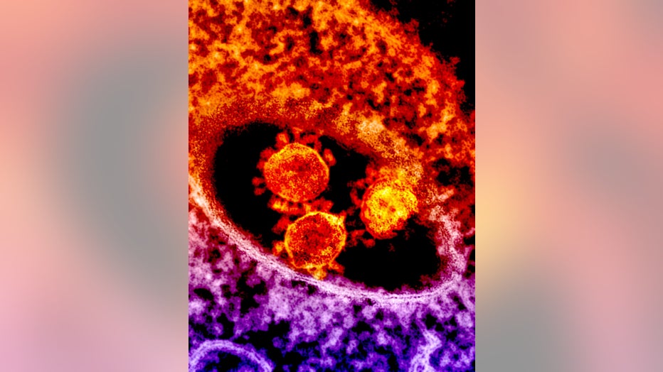 A highly magnified, digitally colorized transmission electron microscopic (TEM) image showing a coronavirus