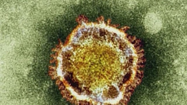 Valley virologist discusses how monsoon season affects COVID-19