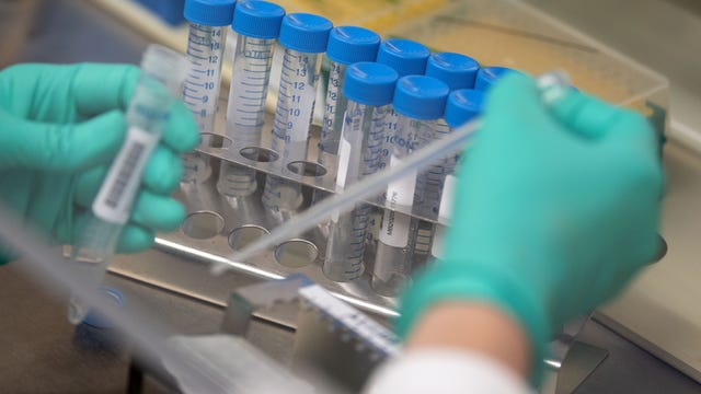 Arizona jump in COVID-19 case count sets daily high record