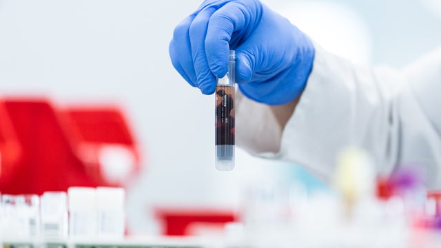 Vitalant to test all blood donations for COVID-19 antibodies