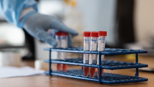 Arizona passes 50,000 mark in confirmed COVID-19 cases