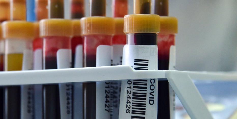 Number of new Arizona COVID-19 cases down after record day