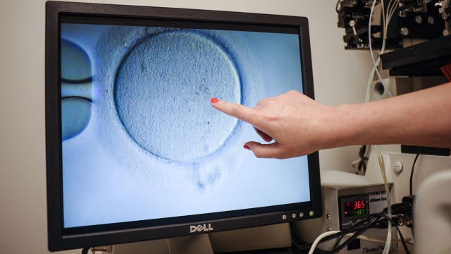California mother files fertility fraud suit, alleging doctor used his own sperm to impregnate her