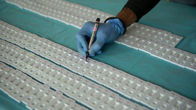 Researchers note decline in brain function in some COVID-19 survivors