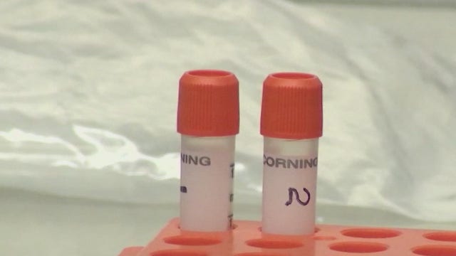 Valley research institute asking anyone who's had COVID-19 to become 'citizen scientists'