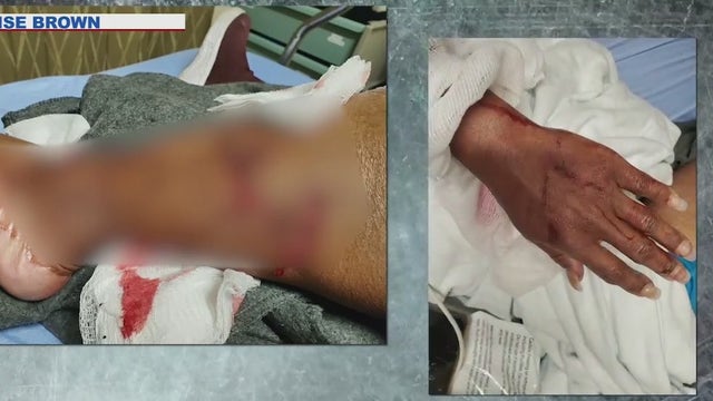 Woman says she was intentionally attacked by a dog in Tempe