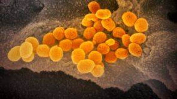 Arizona reports 571 additional COVID-19 cases, 24 deaths