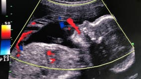 White House announces steps to curb Black maternal mortality rate