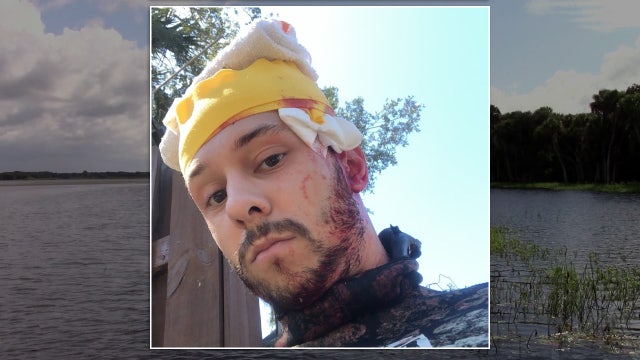 Man, diving for prehistoric shark teeth, bitten by alligator in Myakka River