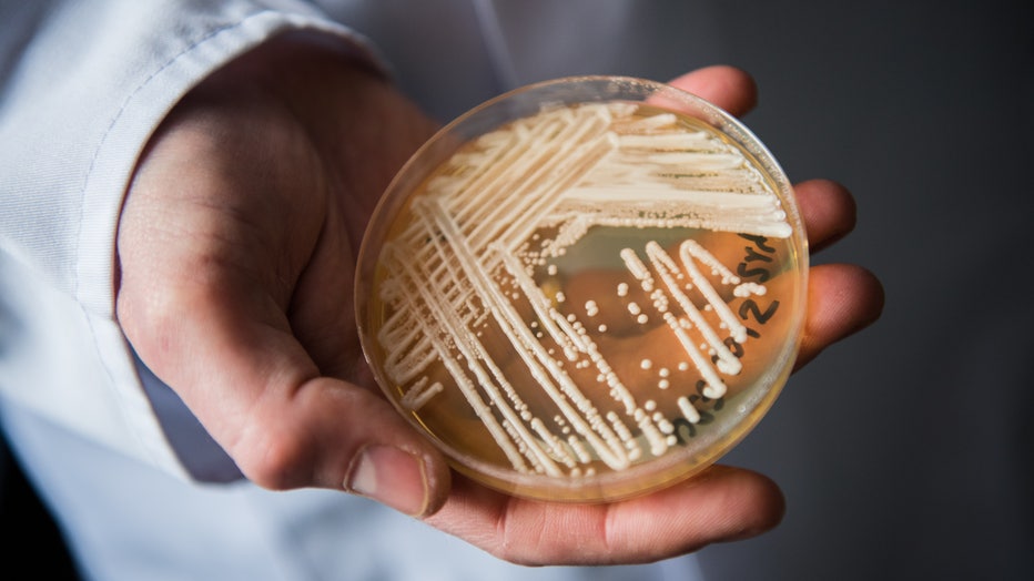 Experts warn of newly-discovered yeast