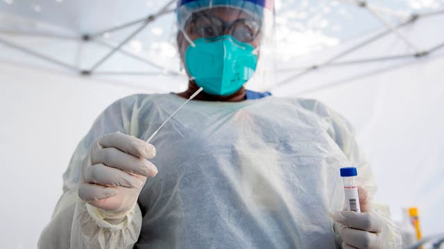 NIH scientists develop faster, less costly COVID-19 test