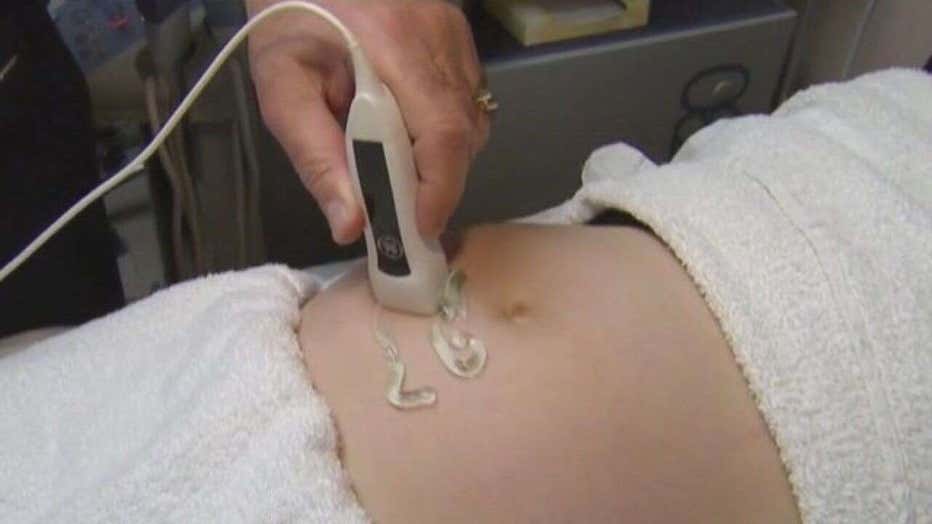A fetal ultrasound
