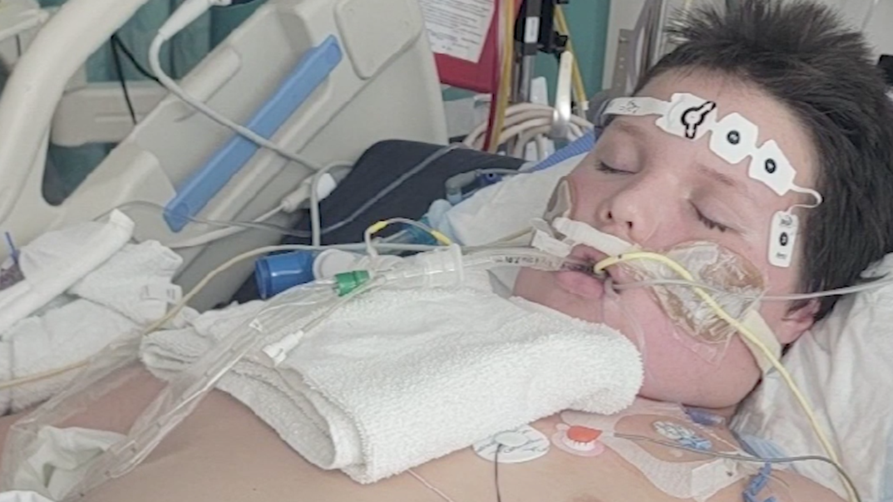 Boy hospitalized, intubated for mysterious illness during family trip to Disney World Boy hospitalized, intubated for mysterious illness during family trip to Disney World