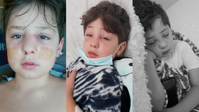 Casa Grande little boy battles serious sinus cavity infection after COVID-19 diagnosis