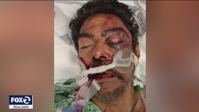 San Jose father ambushed, beaten after hit-and-run driver escapes
