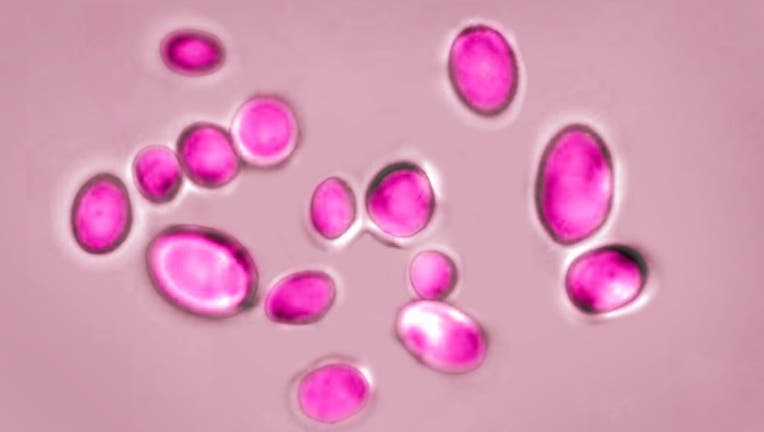 candida auris