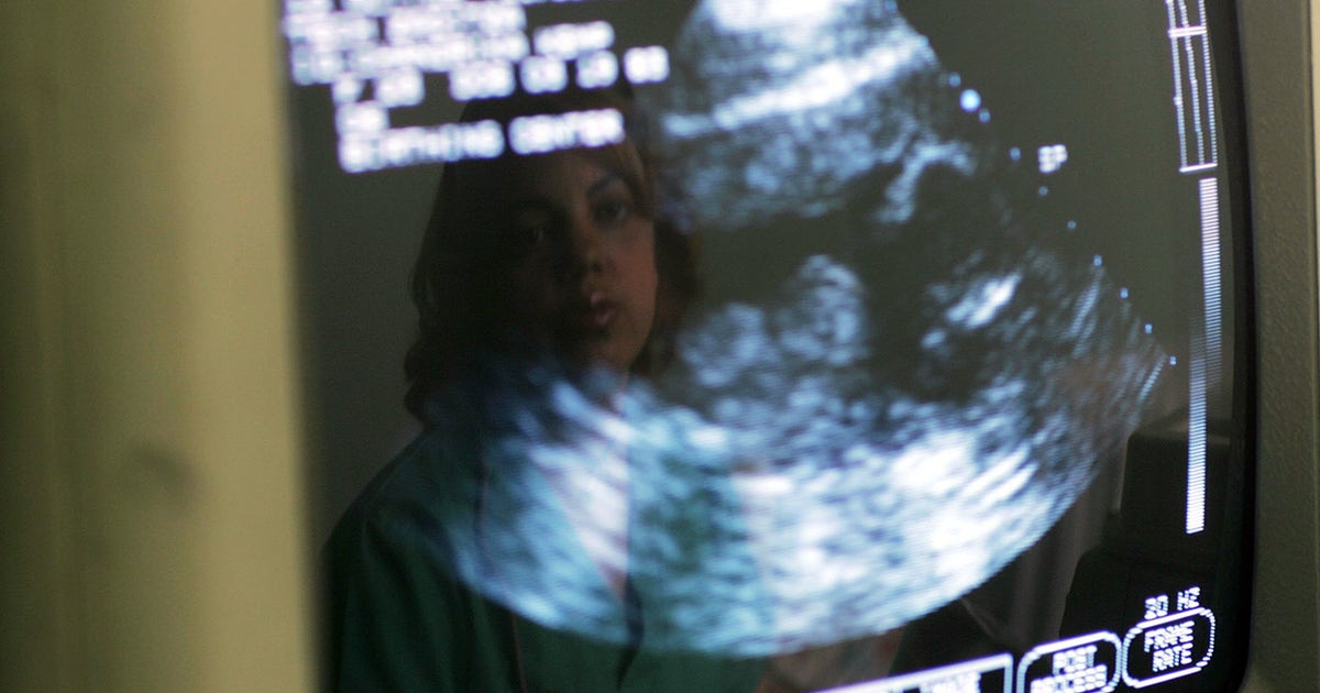 Florida abortion laws: GOP's proposed bill would ban abortions after 15 ...